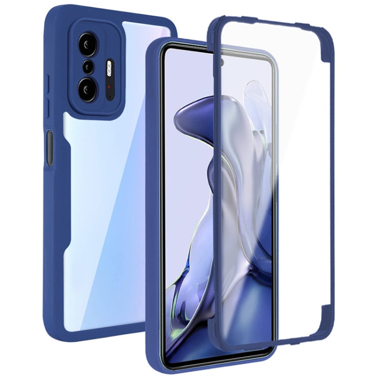 Blue acrylic and TPU phone case with 360° coverage and clear screen protector