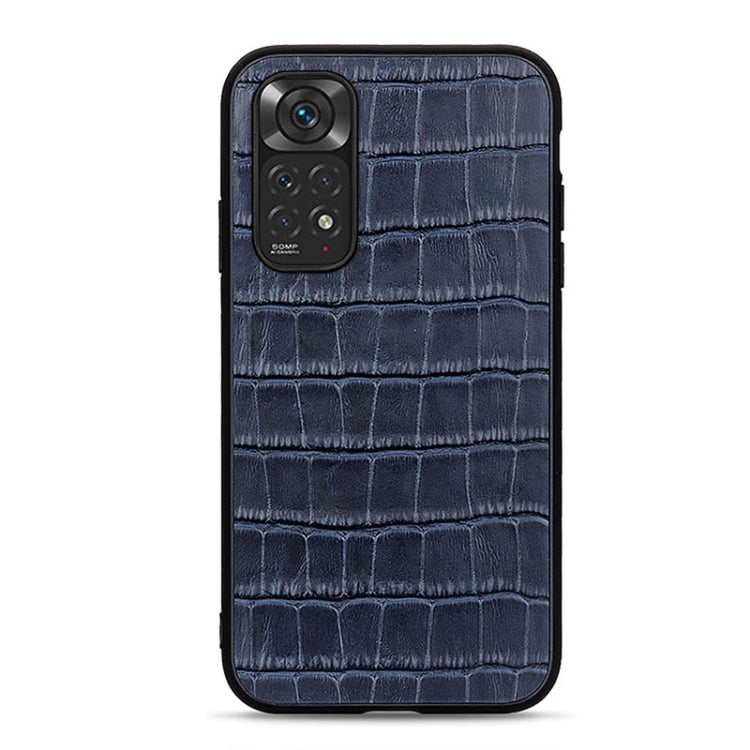 Blue crocodile-texture shockproof phone case with camera cutouts and protective frame