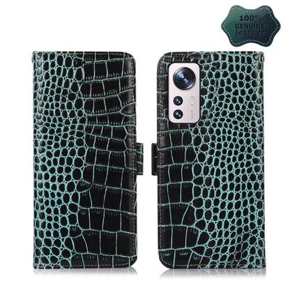 Teal crocodile-pattern leather wallet phone case with flip cover and camera cutout