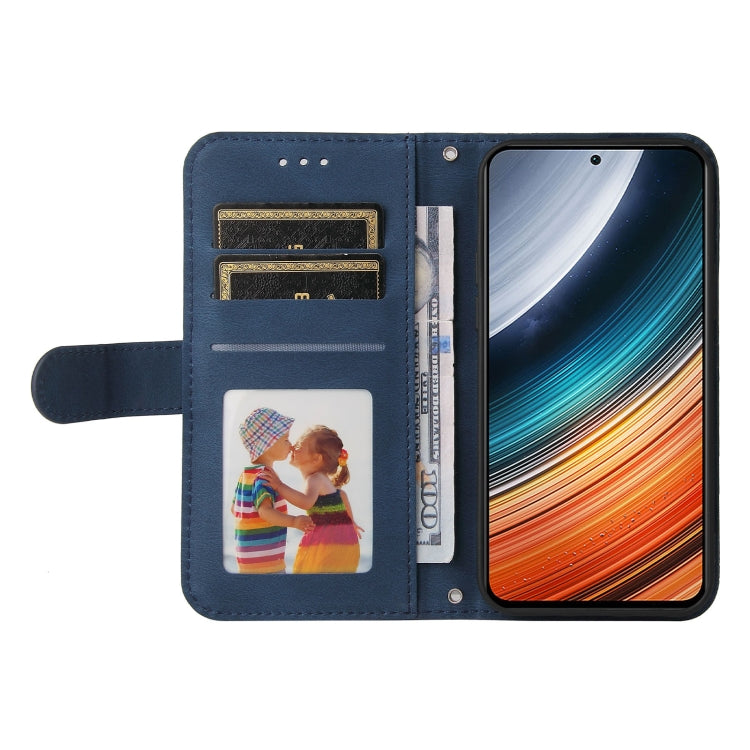Blue leather wallet phone case open view with card slots and photo holder panel.