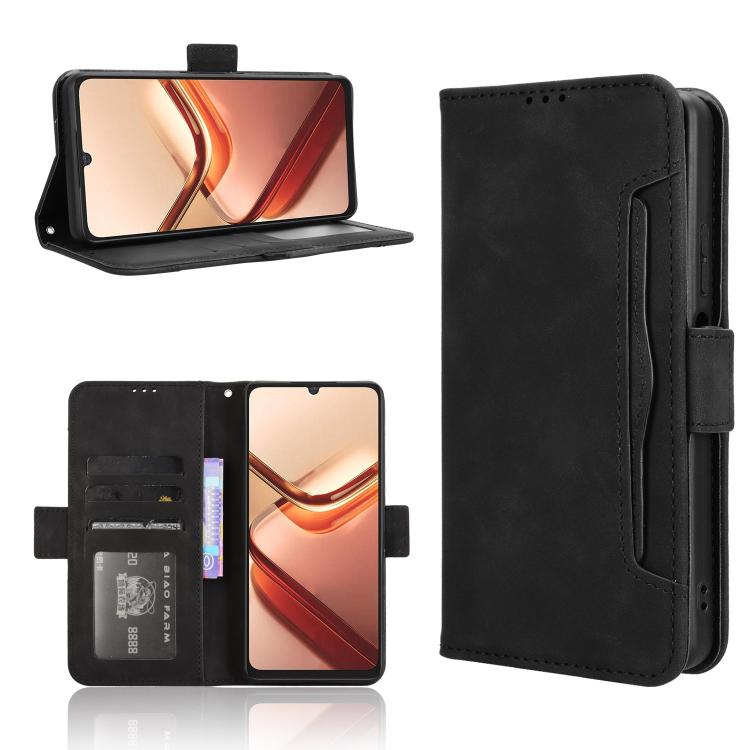 Skin Feel Calf Texture Card Slots Leather Phone Case, For Doogee Note 56X / Note 56X Pro, For Doogee Note 56 / Note 56 Pro, For Doogee Note 59 / Note 59 Pro, For Doogee Note 58 / Note 58 Pro, For Doogee X98