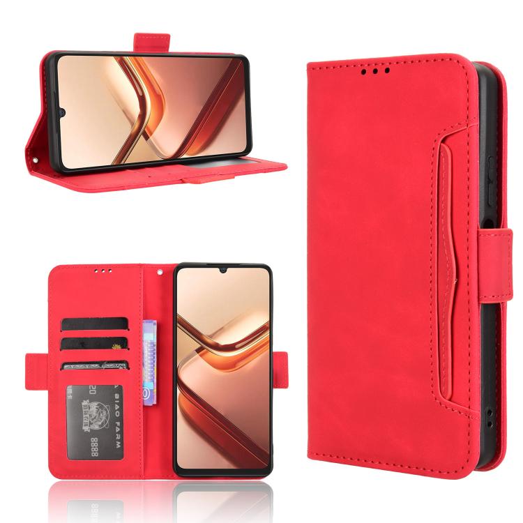 Skin Feel Calf Texture Card Slots Leather Phone Case, For Doogee Note 56X / Note 56X Pro, For Doogee Note 56 / Note 56 Pro, For Doogee Note 59 / Note 59 Pro, For Doogee Note 58 / Note 58 Pro, For Doogee X98