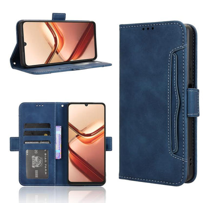 Skin Feel Calf Texture Card Slots Leather Phone Case, For Doogee Note 56X / Note 56X Pro, For Doogee Note 56 / Note 56 Pro, For Doogee Note 59 / Note 59 Pro, For Doogee Note 58 / Note 58 Pro, For Doogee X98