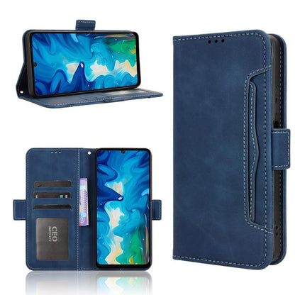 Skin Feel Calf Texture Card Slots Leather Phone Case, For Doogee Note 56X / Note 56X Pro, For Doogee Note 56 / Note 56 Pro, For Doogee Note 59 / Note 59 Pro, For Doogee Note 58 / Note 58 Pro, For Doogee X98